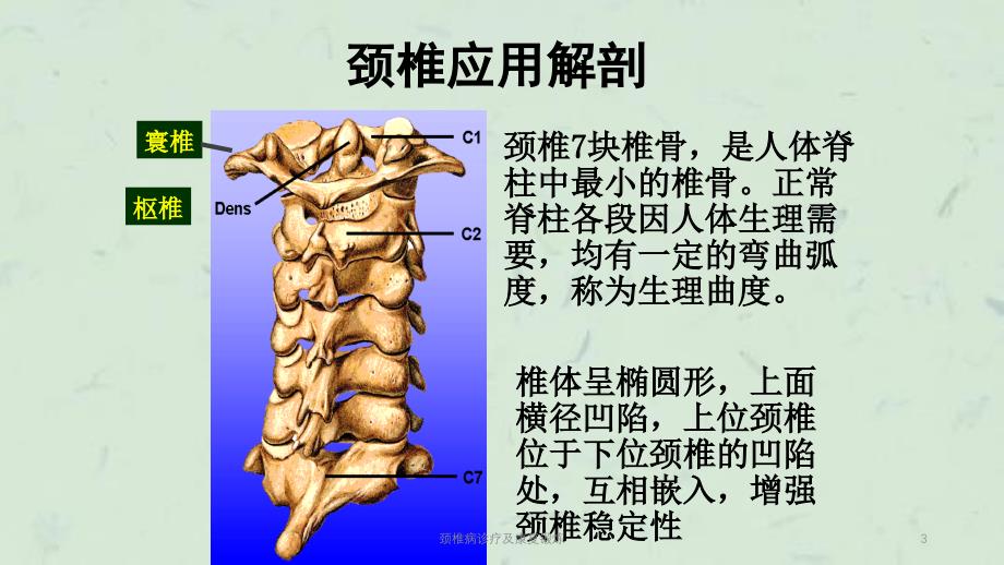 颈椎病诊疗及康复锻炼课件_第3页