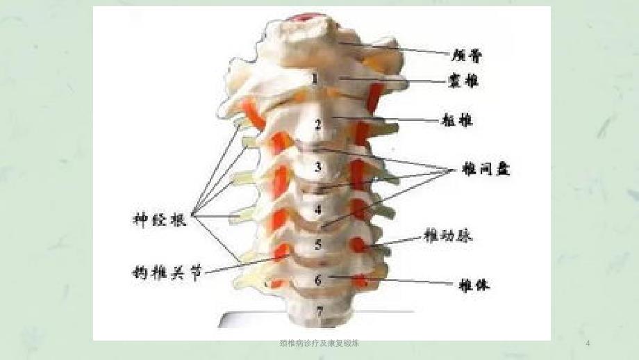 颈椎病诊疗及康复锻炼课件_第4页