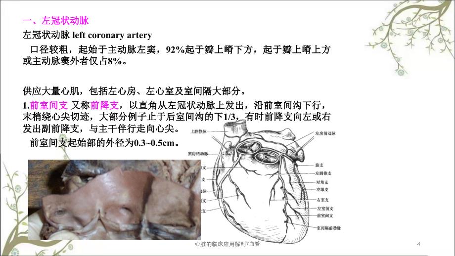 心脏的临床应用解剖7血管_第4页