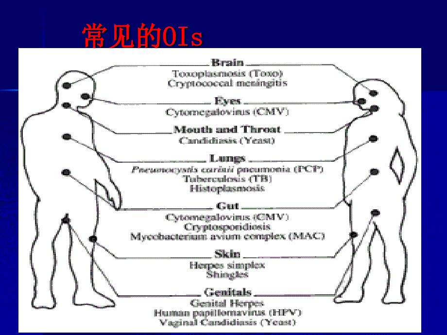 hiv机会感染治疗PPT课件_第2页