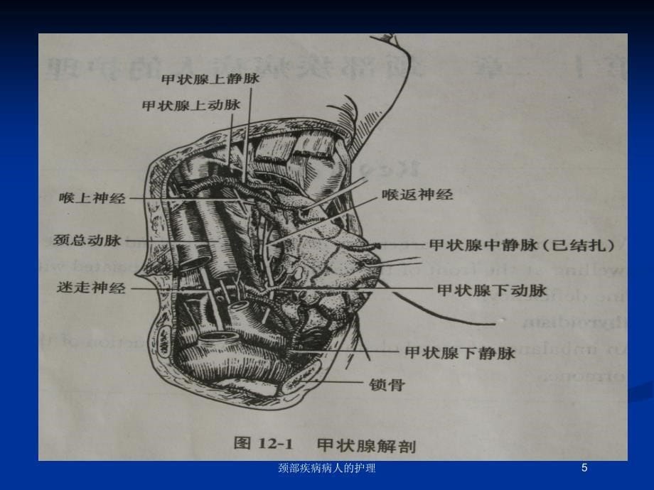 颈部疾病病人的护理培训课件_第5页