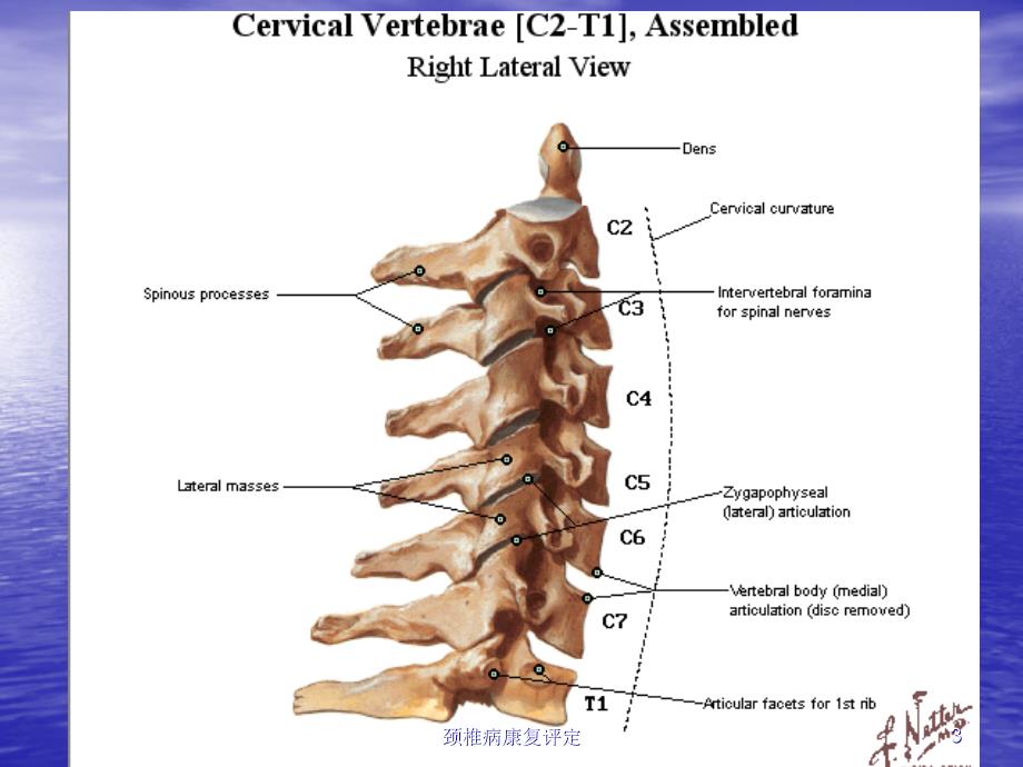 颈椎病康复评定培训课件_第3页
