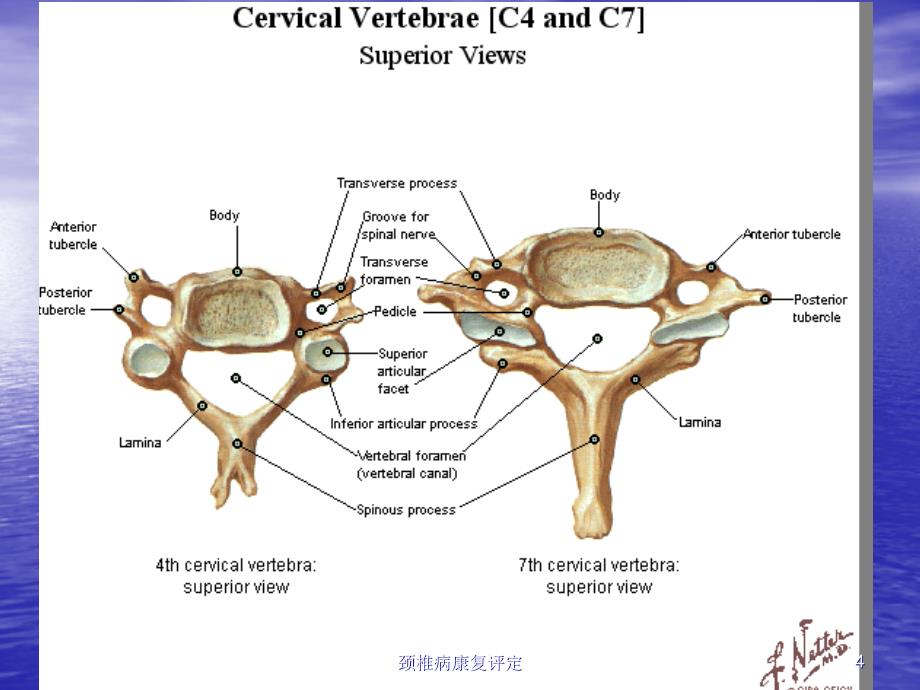 颈椎病康复评定培训课件_第4页