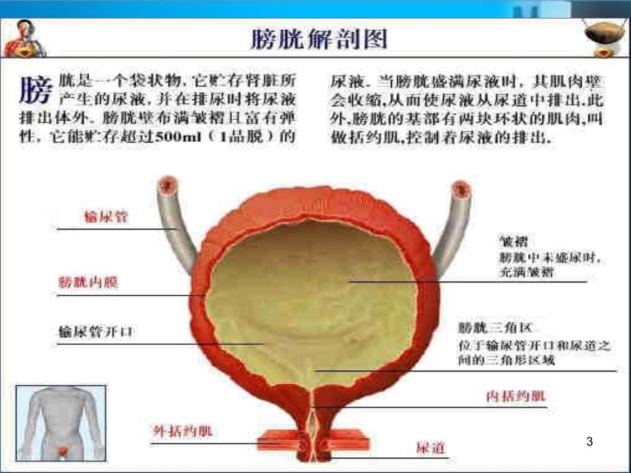 膀胱全切术后护理详解课堂PPT_第3页