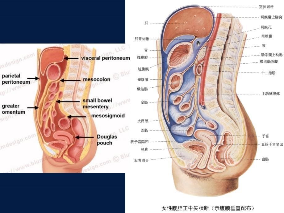 腹膜病变的CT表现.ppt_第5页