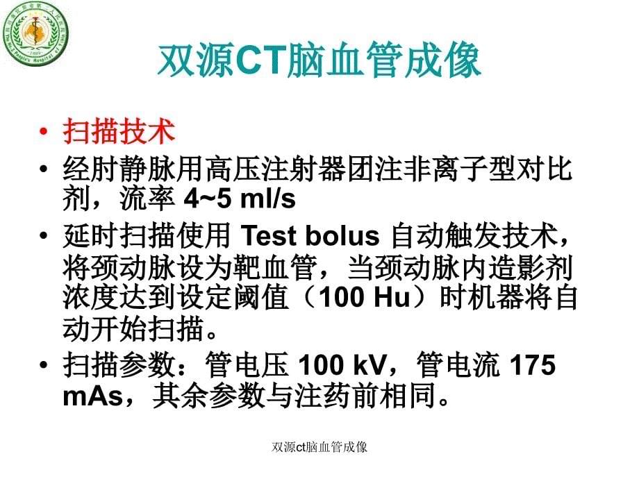 双源ct脑血管成像课件_第5页