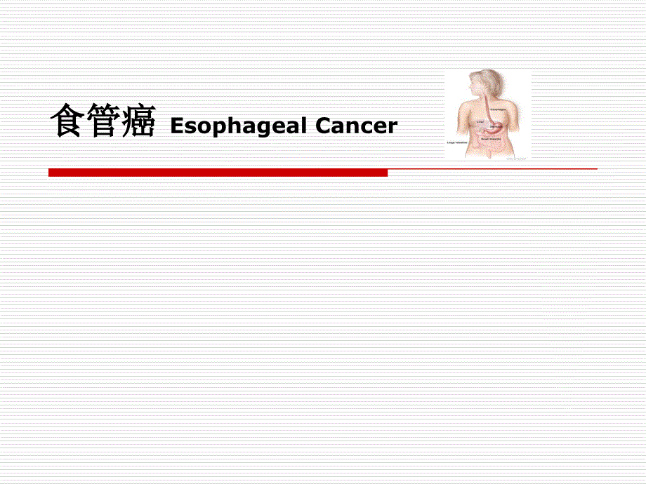 外科学教学课件：食管癌_第1页