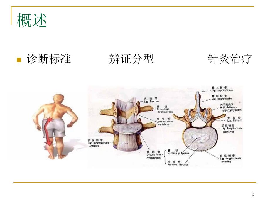 优质课件腰椎间盘突出症的针灸治疗演示_第2页