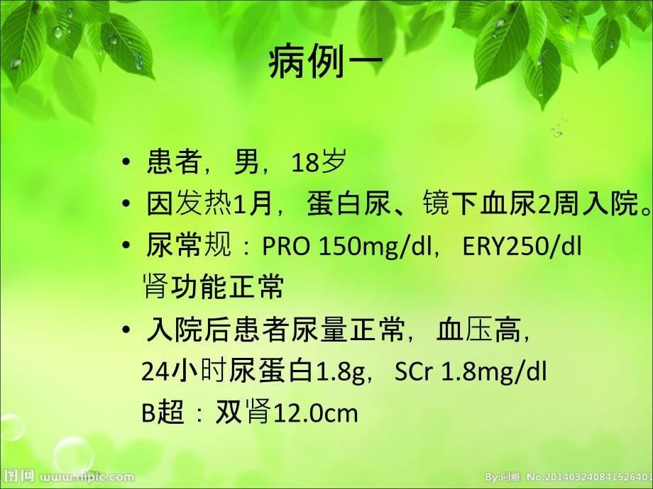 肾穿刺活检术5579_第5页