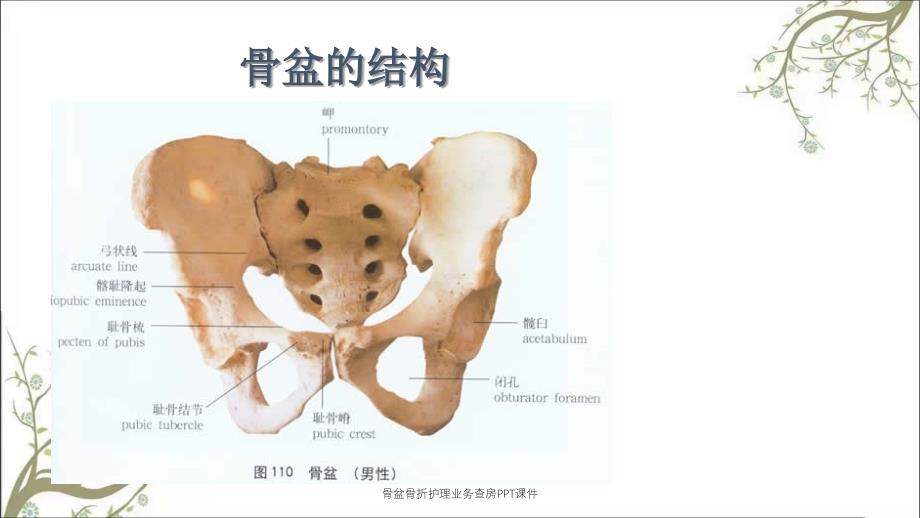 骨盆骨折护理业务查房PPT课件_第4页