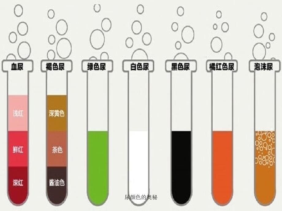 最新尿颜色的奥秘_第3页