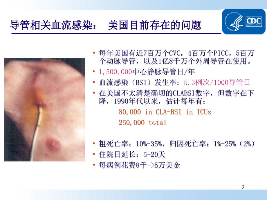 导管相关性血流感染预防和护理_第3页