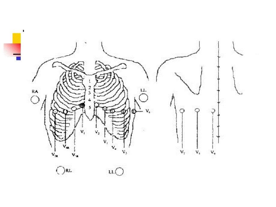 心电图机操作图解_第5页