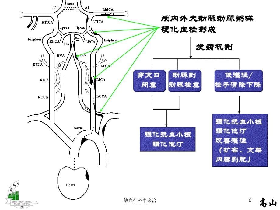 缺血性卒中诊治培训课件_第5页