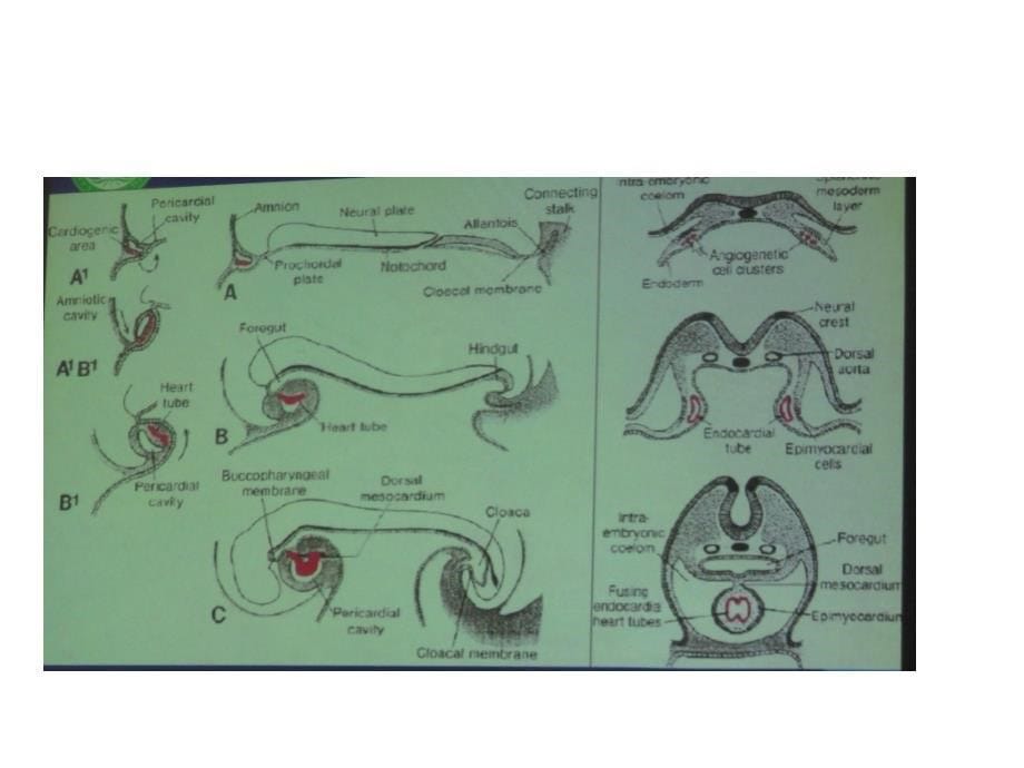 先天性心脏病的胚胎发育.ppt_第5页