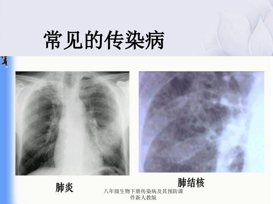 八年级生物下册传染病及其预防课件新人教版_第3页