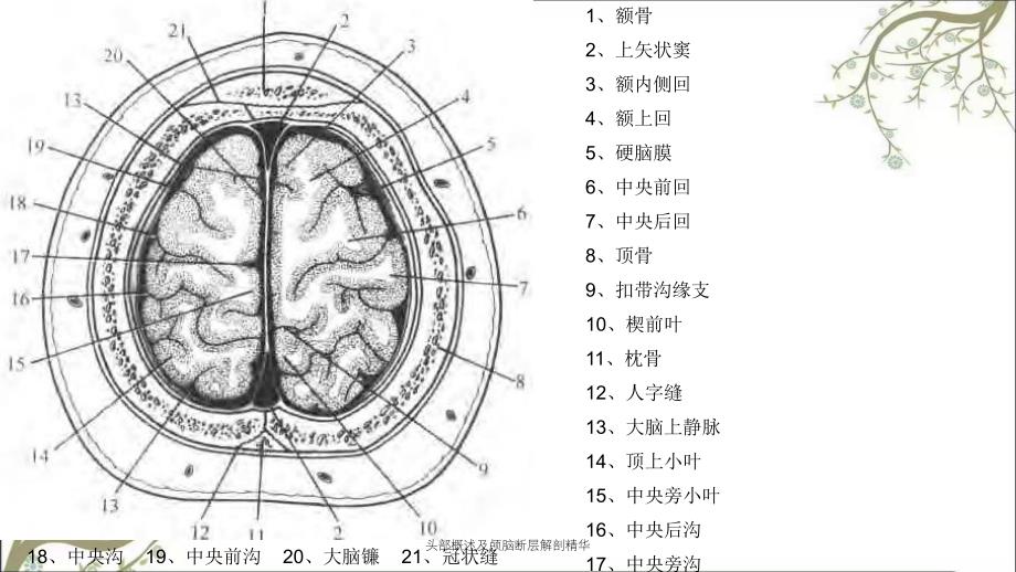 头部概述及颅脑断层解剖精华_第4页