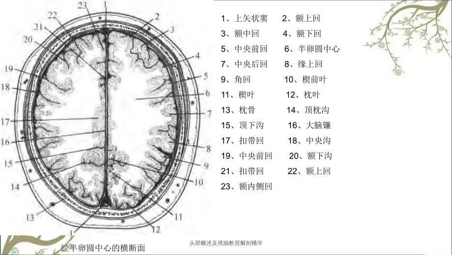 头部概述及颅脑断层解剖精华_第5页