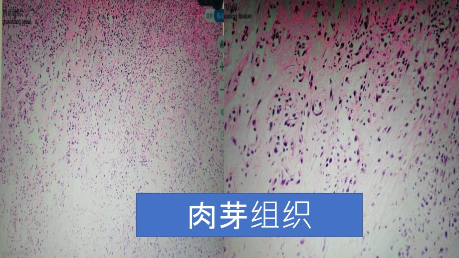 病理切片.ppt_第1页