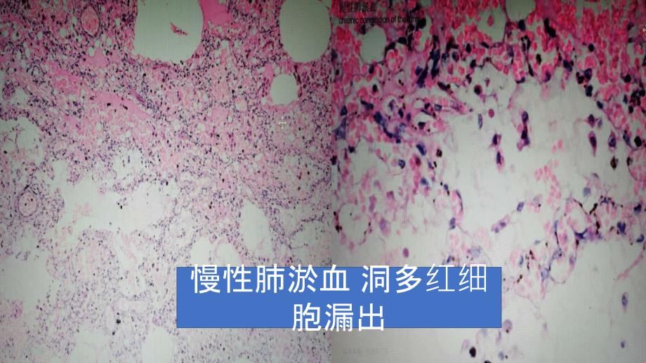 病理切片.ppt_第3页