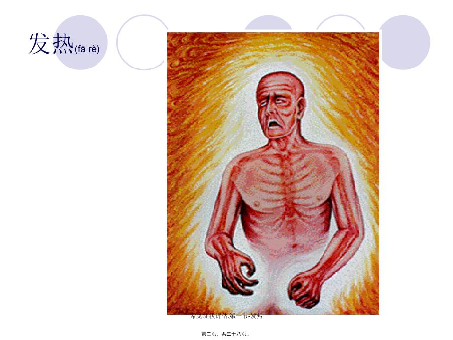 常见症状评估.第一节-发热课件_第2页