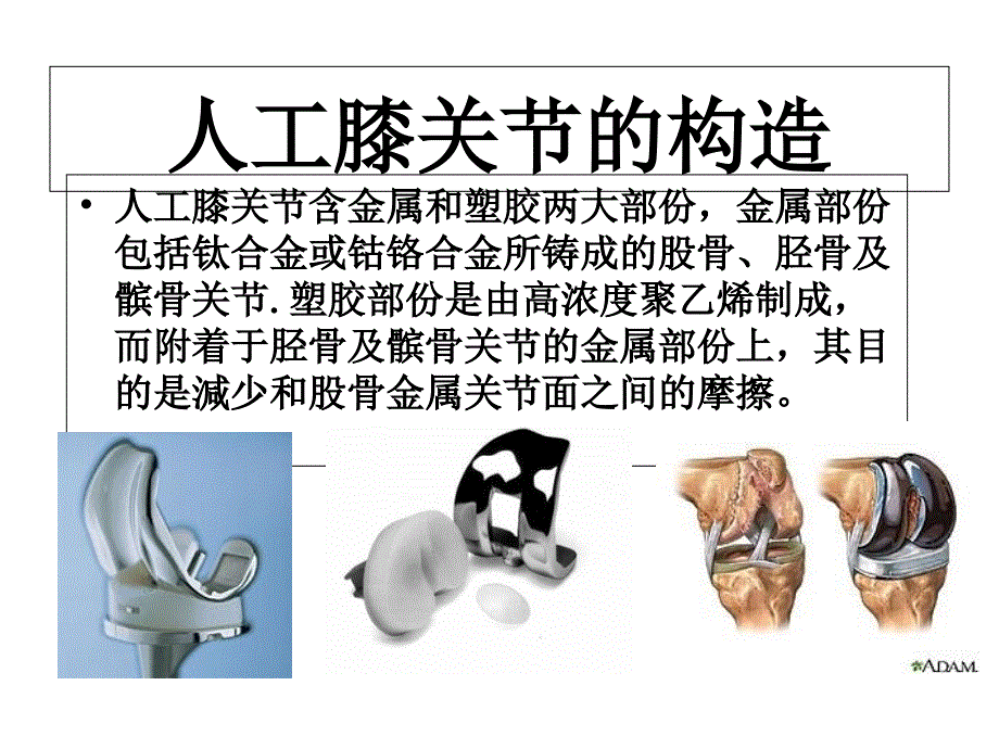 人工全膝关节表面置换术_第3页