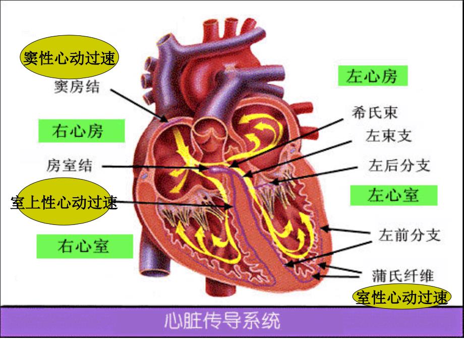 抗心律失常药的概念_第4页