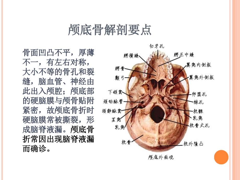 颅底骨折护理标准.ppt_第2页