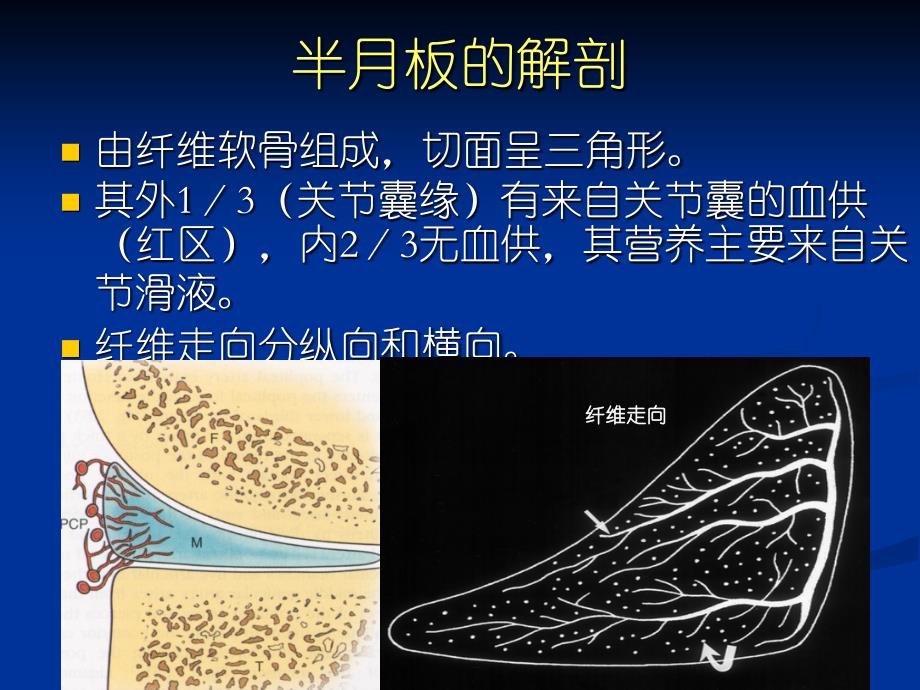 半月板撕裂的MR诊断 PPT课件.ppt_第3页