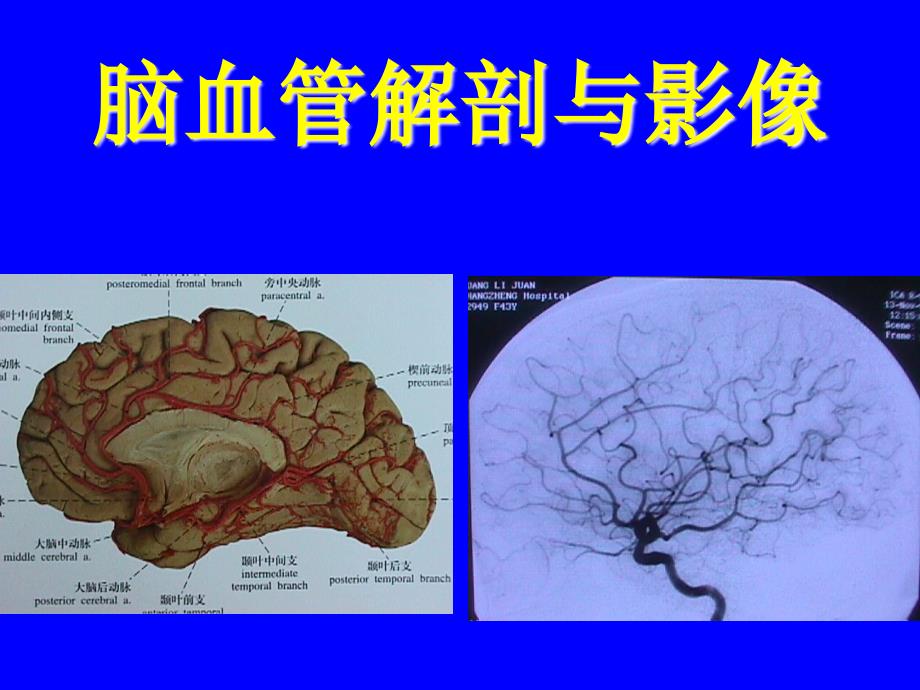 颈内动脉解剖PPT_第1页