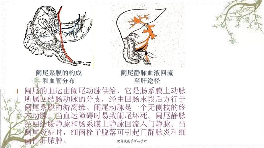 阑尾炎的诊断与手术课件_第5页