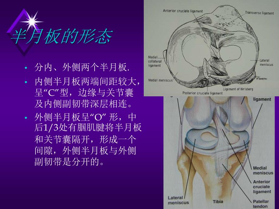 膝关节半月板损伤剖析课件_第3页