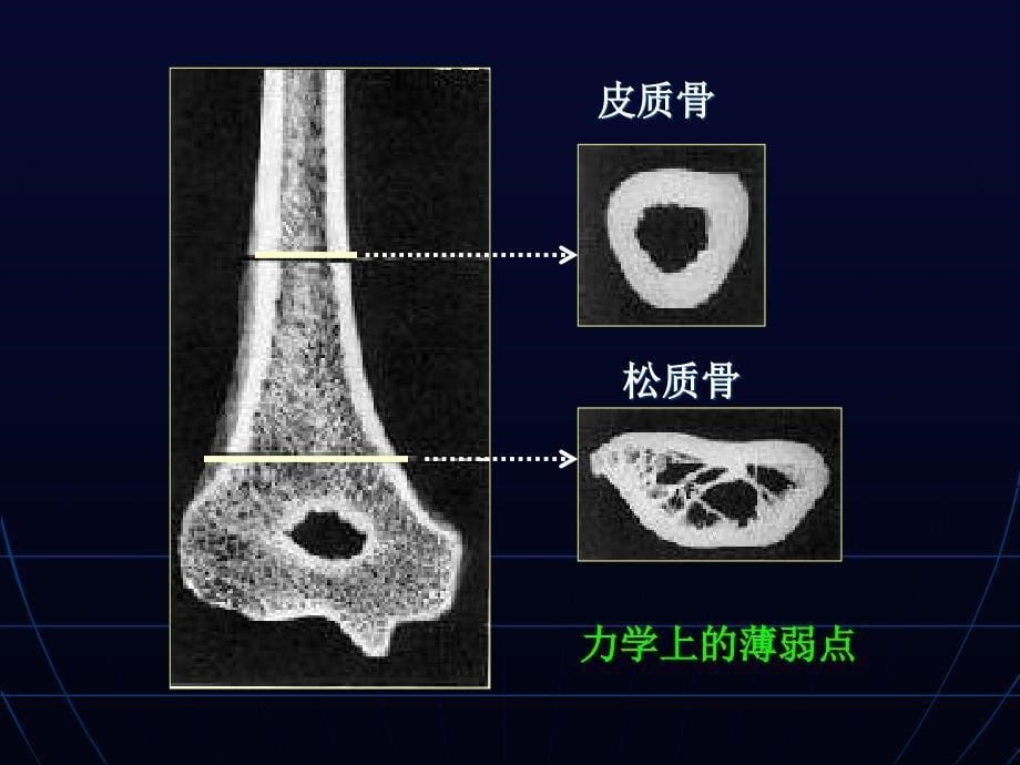 肱骨髁上外髁内上髁骨折_第5页