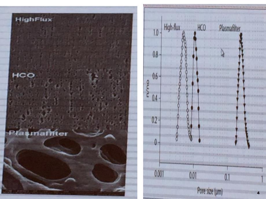 高截留量透析ppt课件_第4页