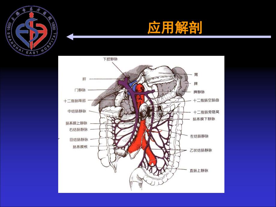 肠系膜静脉血栓PPT课件_第2页