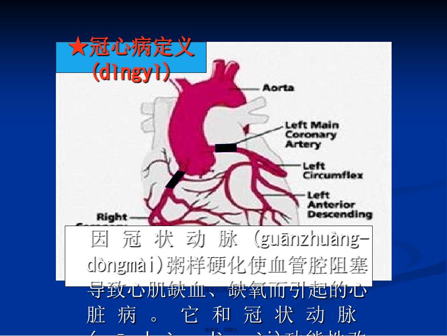 内科护理冠状动脉硬化性心脏病的护理学习教案_第4页