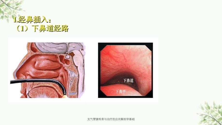 支气管镜检查与治疗的应用解剖学基础课件_第5页