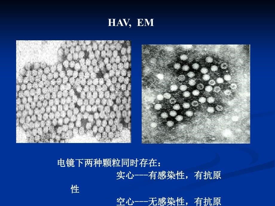 医学微生物学课件：14-肝炎病毒_第5页