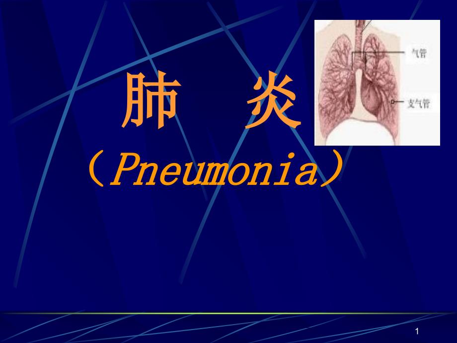 肺炎教学课件_第1页