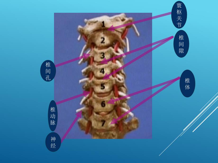 康复护理颈椎病PPT课件_第4页