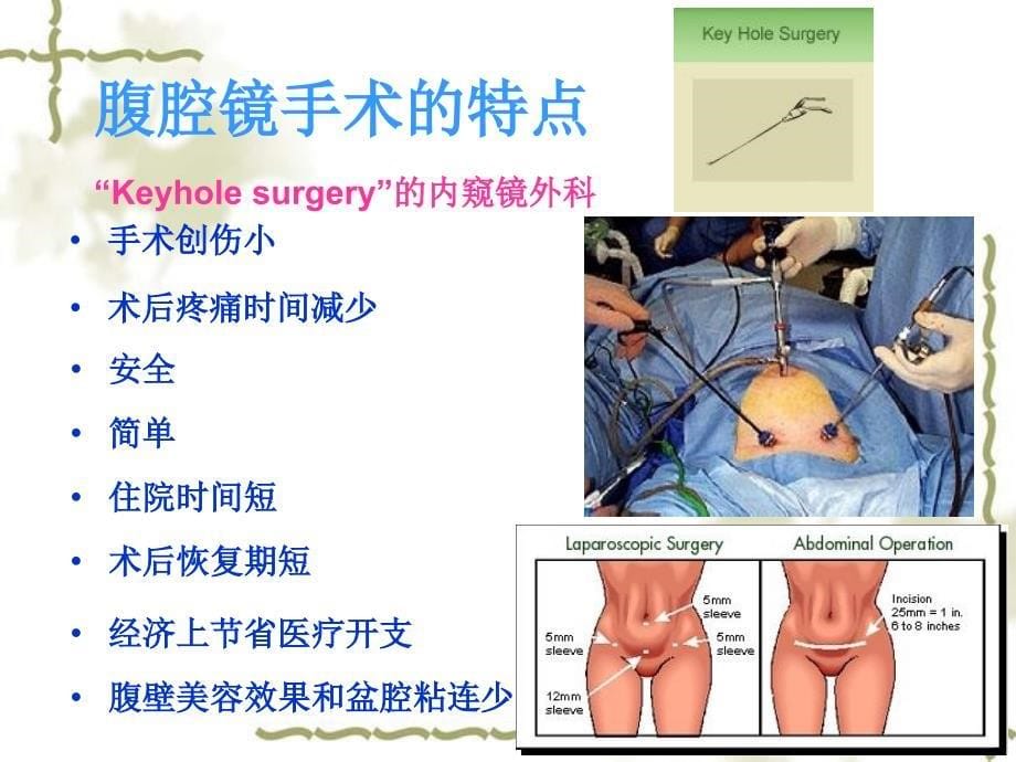 妇科腹腔镜手术并发症的防治_第5页