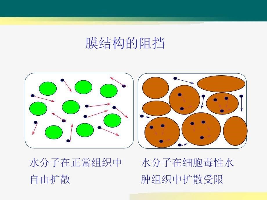 DWI在肝脏占位性疾病中的应用_第5页