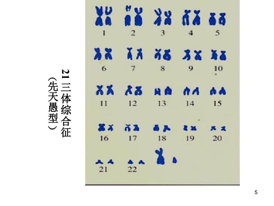 生物5.2染色体变异课件1新人教版必修2_第5页