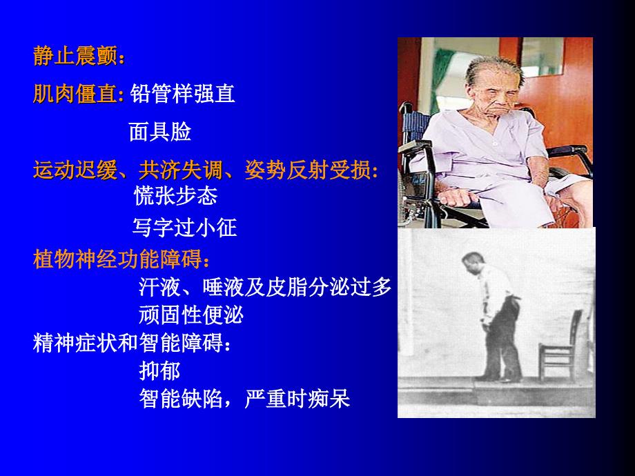 《抗帕金森病药》PPT课件.ppt_第3页