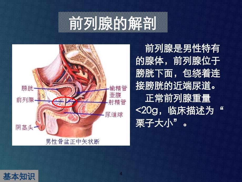 【医学ppt课件】中国良性前列腺增生症诊治指南解读_第4页