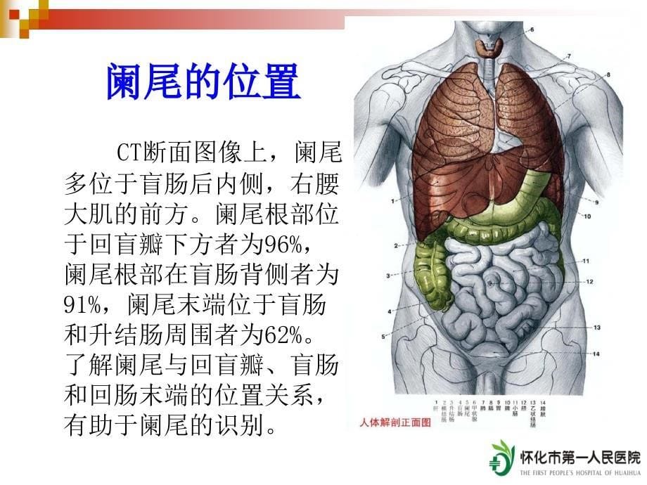 急性阑尾炎的CT诊断_第5页