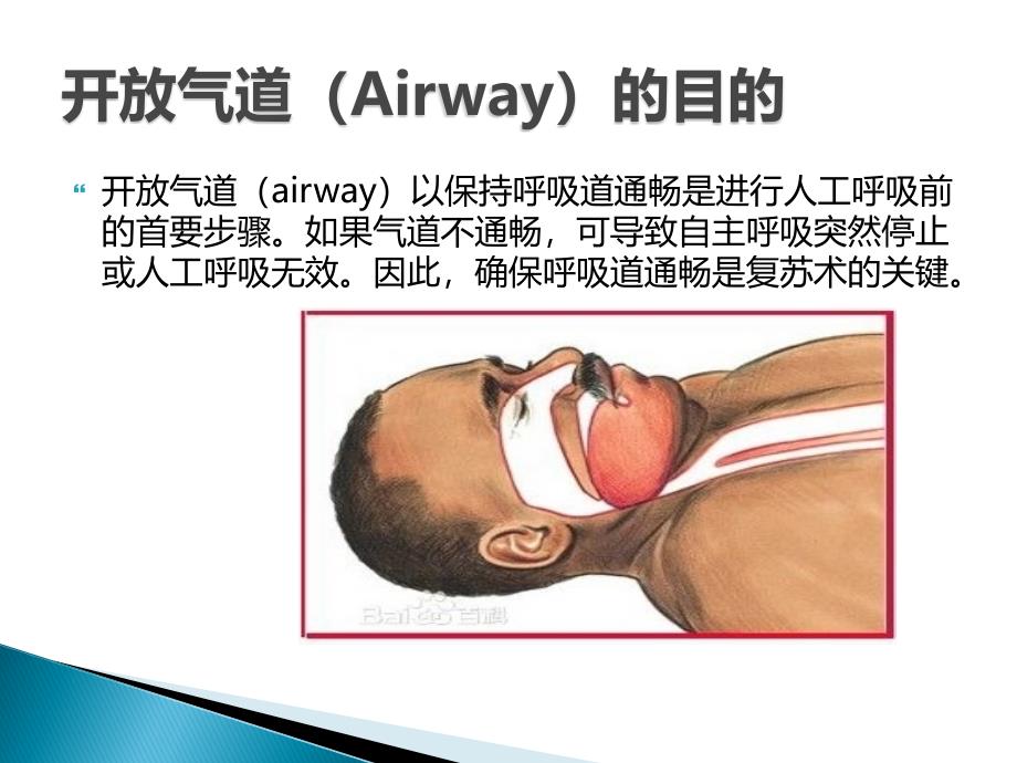 心肺复苏-开放气道.ppt_第2页