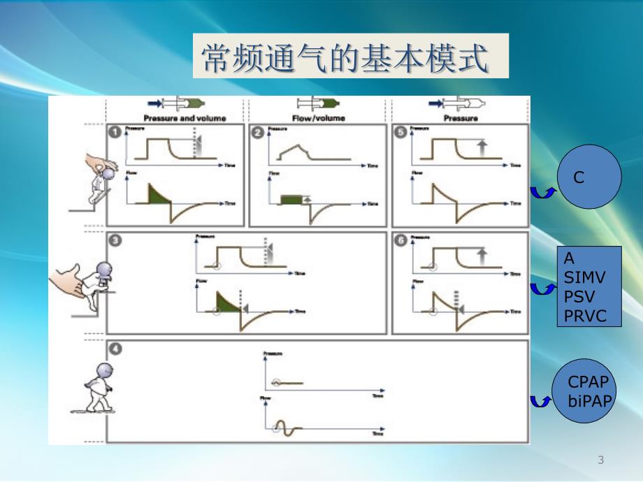 新生儿常见肺部疾病辅助通气策略 ppt课件_第3页