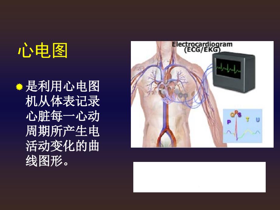 本心电图ppt课件_第3页