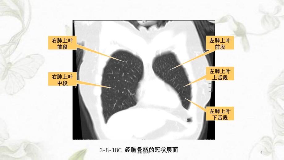 胸部冠状面、矢状面解剖与影像课件_第4页